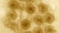 Thin-section electron microscopy of an agar overlay containing plaques of the representative Autolykiviridae virus 1.008.O; virus particles in contact with cell membranes are observed to occasionally possess tail-tube-like structures, whereas those not in contact with cells do not. Image credit: Kauffman et al, doi: 10.1038/nature25474.