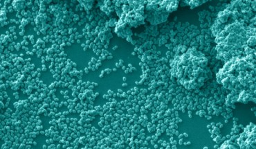Enterococci. Image credit: Francois Lebreton, MEEI.