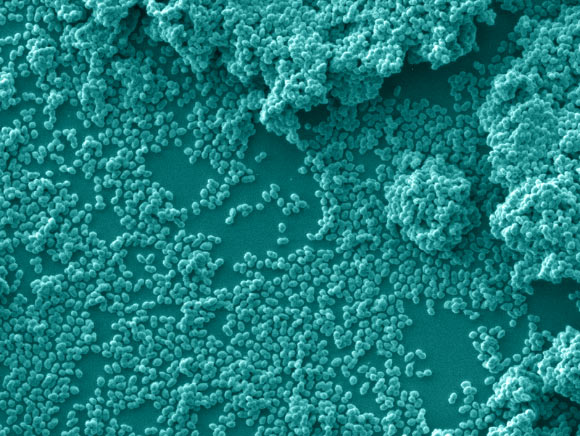 Enterococci. Image credit: Francois Lebreton, MEEI.