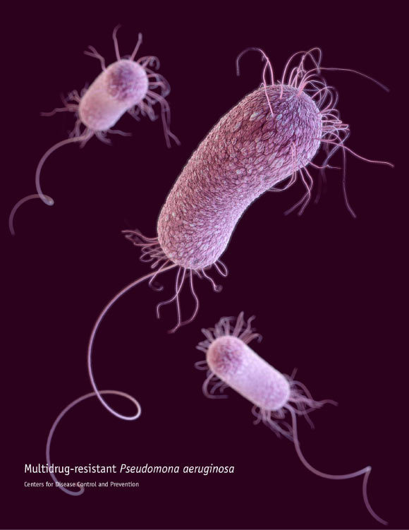 This illustration depicts a 3D computer-generated image of three multidrug-resistant Pseudomonas aeruginosa bacteria. Image credit: James Archer / CDC.