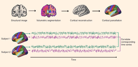 Parkinson et al show evidence for neural homophily -- neural responses when viewing audiovisual movies are exceptionally similar among friends, and that similarity decreases with increasing distance in a real-world social network. Image credit: Parkinson et al, doi: 10.1038/s41467-017-02722-7.