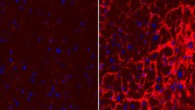 Chondroitin sulfate (marked in red), virtually absent in healthy human heart tissue (left panel), is found to accumulate in hearts of patients with heart failure, forming dense molecular ‘nets’ around the heart muscle cells (right panel). Cell nuclei are marked in blue. Scale bar - 50 μm. Image credit: National University Heart Centre, Singapore.
