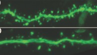 African grass rats (Arvicanthis niloticus) exposed to dim lights (DLD) for four weeks experienced, on average, a 30% decrease in the number of ‘dendritic spine’ connections in their brains, which are the tiny protrusions near the solid green line, a dendrite. These rats performed poorly on a maze-like task. Rats exposed to bright light (BLD), on the other hand, had many more of the dendritic connections and showed superior performance on the task. Image credit: Michigan State University.