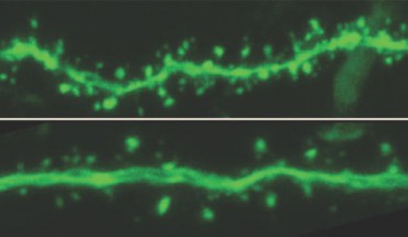 African grass rats (Arvicanthis niloticus) exposed to dim lights (DLD) for four weeks experienced, on average, a 30% decrease in the number of ‘dendritic spine’ connections in their brains, which are the tiny protrusions near the solid green line, a dendrite. These rats performed poorly on a maze-like task. Rats exposed to bright light (BLD), on the other hand, had many more of the dendritic connections and showed superior performance on the task. Image credit: Michigan State University.