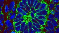 Section from a kidney progenitor-derived mass harvested from a mouse intravenously injected with low-molecular-weight, fluorescein isothiocyanate-labeled dextran. Image credit: Bantounas et al, doi: 10.1016/j.stemcr.2018.01.008.