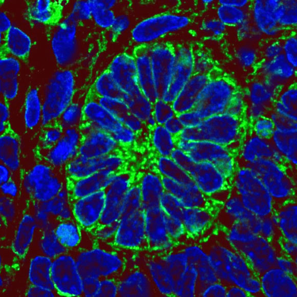 Section from a kidney progenitor-derived mass harvested from a mouse intravenously injected with low-molecular-weight, fluorescein isothiocyanate-labeled dextran. Image credit: Bantounas et al, doi: 10.1016/j.stemcr.2018.01.008.