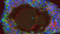 Magnification of a lab-grown, fully matured human egg ready for fertilization. Image credit: University of Edinburgh.