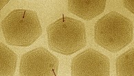 Marseilleviridae particles; arrows indicate ‘large dense bodies.’ Image credit: Okamoto et al, doi: 10.1101/139097.