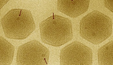 Marseilleviridae particles; arrows indicate ‘large dense bodies.’ Image credit: Okamoto et al, doi: 10.1101/139097.