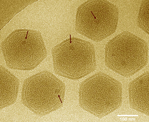 Marseilleviridae particles; arrows indicate ‘large dense bodies.’ Image credit: Okamoto et al, doi: 10.1101/139097.