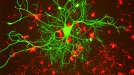 Light-controlled neuron activation using optogenetics allows modulation of specific circuits but is invasive and requires genetic engineering. Researchers from the University of Chicago have developed a silicon-based nanowire that allows light modulation of neurons without genetic engineering, paving the way for optical control of neural activity to other neurological models. Image credit: Gerry Shaw / CC BY-SA 3.0.