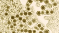 Transmission electron micrograph of ranaviruses (hexagons), members of the family Iridoviridae. Image credit: Electron Microscopy Unit, Australian Animal Health Laboratory / CSIRO.