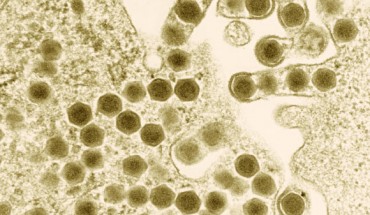 Transmission electron micrograph of ranaviruses (hexagons), members of the family Iridoviridae. Image credit: Electron Microscopy Unit, Australian Animal Health Laboratory / CSIRO.