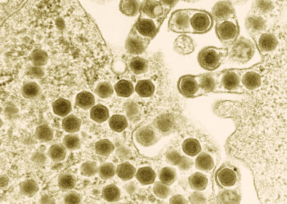 Transmission electron micrograph of ranaviruses (hexagons), members of the family Iridoviridae. Image credit: Electron Microscopy Unit, Australian Animal Health Laboratory / CSIRO.