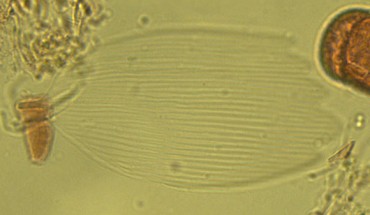 A well-preserved scale extracted from a lake sediment core. Image credit: Montoro Girona et al, doi: 10.3389/fevo.2018.00002.