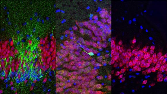 Young neurons (green) decrease in the human hippocampus across the lifespan, vs more mature neurons (red). Image credit: Sorrells et al.