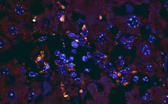 Enterococcus gallinarum (orange dots) in liver tissue. Image credit: Vieira et al.