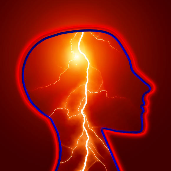 Malik et al conducted a multiancestry genome-wide-association meta-analysis in 521,612 individuals (67,162 cases and 454,450 controls) and discovered 22 new stroke risk loci, bringing the total to 32. Image credit: Gerd Altmann.