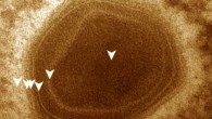 Mature BsV virion: DNA containing core is surrounded by two membranous layers; the capsid consists of at least two proteinaceous layers; the bright halo hints to the presence of short fibers; the top vertex of the virion contains a possible stargate structure. Scale bar - 100 nm. Image credit: Deeg et al, doi: 10.7554/eLife.33014.