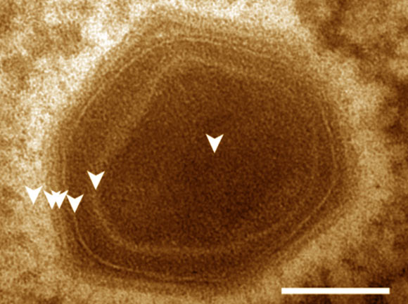Mature BsV virion: DNA containing core is surrounded by two membranous layers; the capsid consists of at least two proteinaceous layers; the bright halo hints to the presence of short fibers; the top vertex of the virion contains a possible stargate structure. Scale bar - 100 nm. Image credit: Deeg et al, doi: 10.7554/eLife.33014.