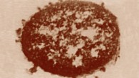 Thin section of a Xenorhabdus nematophila cell, showing outer membrane blebs on the surface of the cell and in the surrounding area. Image credit: Mattia2 / Kenyon College.