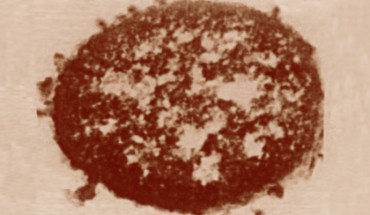 Thin section of a Xenorhabdus nematophila cell, showing outer membrane blebs on the surface of the cell and in the surrounding area. Image credit: Mattia2 / Kenyon College.