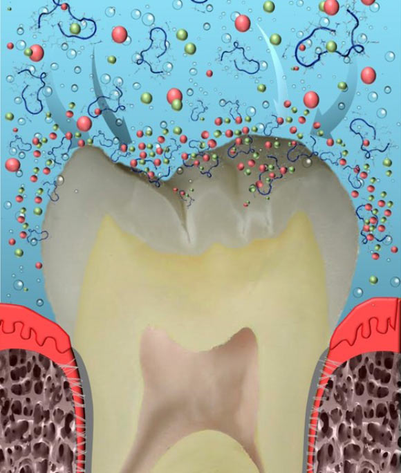 Dogan et al developed a way to cure dental cavities. Image credit: University of Washington.