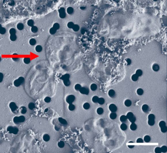 Three major populations from Echinus Geyser, Yellowstone National Park: Marsarchaeota (>1 µm cocci, red arrow), Thermocladium spp. (0.3–0.4 µm diameter filaments), and Sulfolobus islandicus-like organisms (<0.8 µm cocci). Scale bar - 1 µm. Image credit: Jay et al, doi: 10.1038/s41564-018-0163-1.