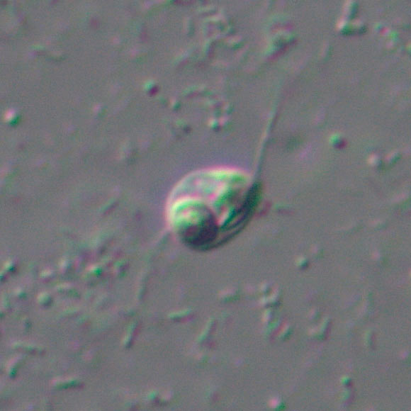 Ancoracysta twista: differential interference contrast microscopy of a cell; two flagella, the feeding gullet, nucleus and a posterior digestive vacuole are visible. Image credit: Denis V. Tiknonenkov.