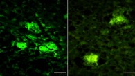 Thioflavin S positive amyloid plaques in the hippocampus (left) and cortex of lab mice inoculated with the artificial human prion, rhuPrion. Image credit: Kim et al, doi: 10.1038/s41467-018-04584-z.