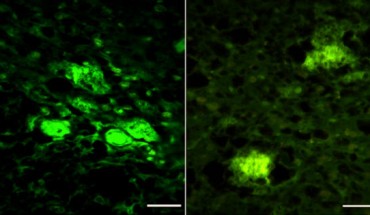 Thioflavin S positive amyloid plaques in the hippocampus (left) and cortex of lab mice inoculated with the artificial human prion, rhuPrion. Image credit: Kim et al, doi: 10.1038/s41467-018-04584-z.
