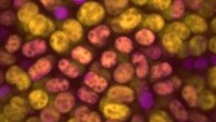 Colony of Chroococcidiopsis thermalis cells where the different colors represent photosynthesis driven by chlorophyll-a (magenta) and chlorophyll-f (yellow). Image credit: Dennis Nuernberg.