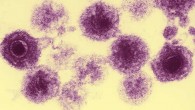 An electron micrograph of human herpesvirus-6 particles. Image credit: Bernard Kramarsky / Laboratory Of Tumor Cell Biology, National Cancer Institute, National Institutes of Health, U.S. Department of Health and Human Services.