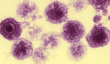 An electron micrograph of human herpesvirus-6 particles. Image credit: Bernard Kramarsky / Laboratory Of Tumor Cell Biology, National Cancer Institute, National Institutes of Health, U.S. Department of Health and Human Services.