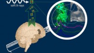 Everett et al scanned amyloid plaque cores using state-of-the-art X-ray microscopy to determine the chemical properties of the minerals within them. Image credit: University of Warwick.