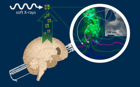 Everett et al scanned amyloid plaque cores using state-of-the-art X-ray microscopy to determine the chemical properties of the minerals within them. Image credit: University of Warwick.