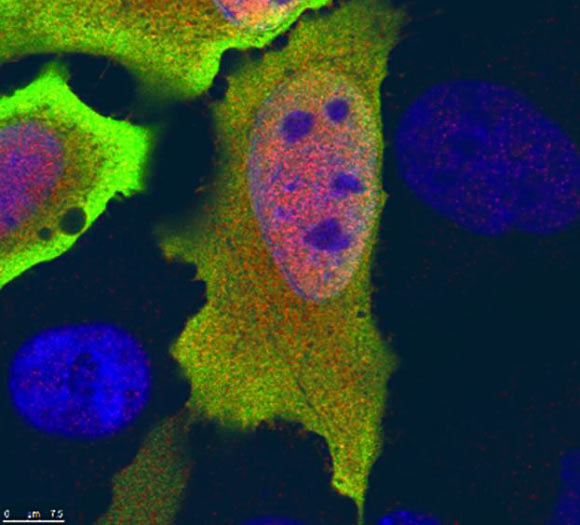 The C6orf106 gene controls the production of proteins involved in infectious diseases, cancer and diabetes. Image credit: CSIRO.