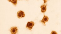 This transmission electron microscopic image depicts numbers of cytomegalovirus virions. Image credit: Sylvia Whitfield / CDC.