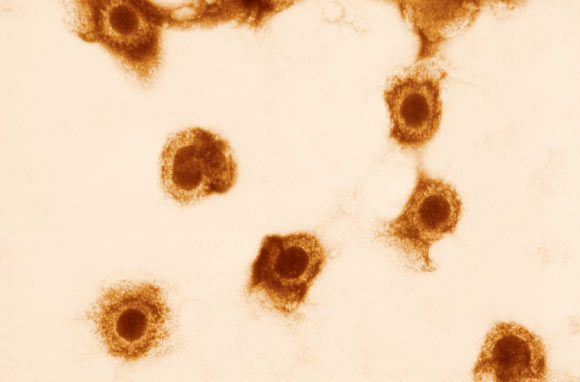 This transmission electron microscopic image depicts numbers of cytomegalovirus virions. Image credit: Sylvia Whitfield / CDC.
