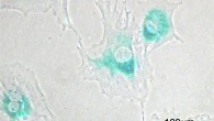 Microscopic image of senescence on mouse embryonic fibroblast cells; blue-green areas indicate the expression of senescence-associated beta-galactosidase. Image credit: Y. Tambe / CC BY-SA 3.0.