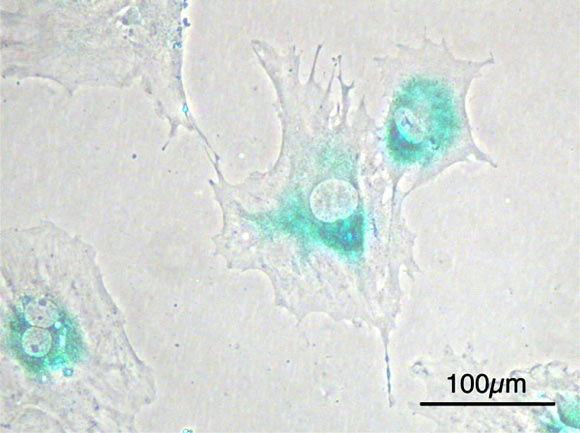 Microscopic image of senescence on mouse embryonic fibroblast cells; blue-green areas indicate the expression of senescence-associated beta-galactosidase. Image credit: Y. Tambe / CC BY-SA 3.0.