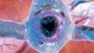 Abnormal accumulations of a protein called tau can collect inside neurons, forming tangled threads and eventually harming the synaptic connection between neurons. Image credit: National Institute on Aging / National Institutes of Health.