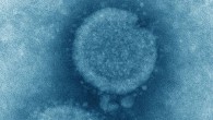 This transmission electron microscopic (TEM) image captured some of the ultrastructural details exhibited by the influenza A (H7N9) virus. Image credit: Cynthia S. Goldsmith & Thomas Rowe, CDC.