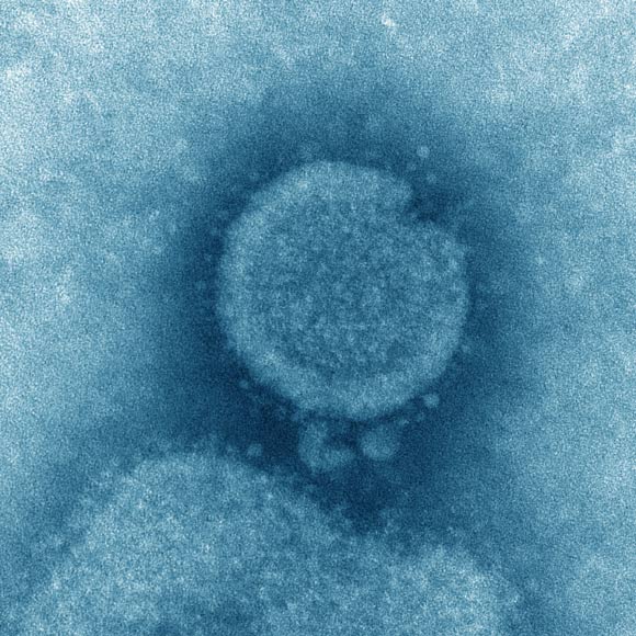 This transmission electron microscopic (TEM) image captured some of the ultrastructural details exhibited by the influenza A (H7N9) virus. Image credit: Cynthia S. Goldsmith & Thomas Rowe, CDC.