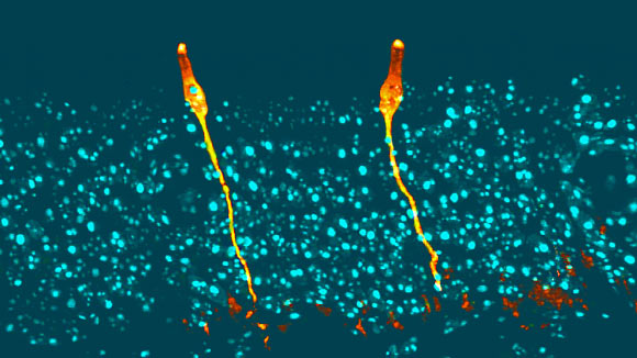 Pulmonary ionocytes (orange) extend through neighboring epithelial cells in the upper respiratory tract of the mouse, to the surface of the epithelial lining; cell nuclei in cyan. Image credit: Montoro et al, doi: 10.1038/s41586-018-0393-7.