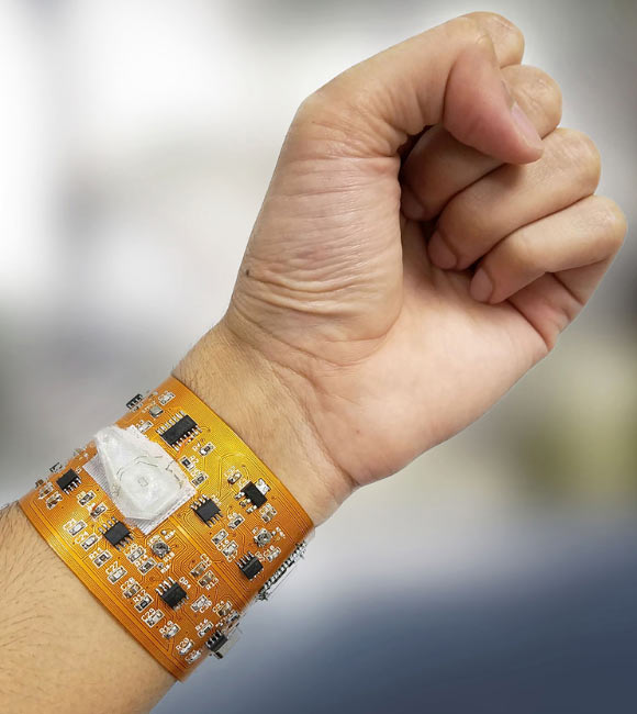 Wearable cytometry system on flexible PCB with integrated microfluidic polydimethylsiloxane chip, microcontroller, and BLE (Bluetooth Low Energy) readout to smartphone (not shown). Image credit: Furniturewalla et al, doi: 10.1038/s41378-018-0019-0.