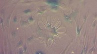 Cellular senescence in human cells. Image credit: Eva Latorre.