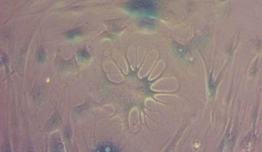 Cellular senescence in human cells. Image credit: Eva Latorre.