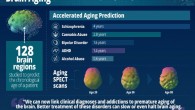 Drivers of brain aging. Image credit: Daniel G. Amen.