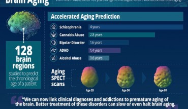 Drivers of brain aging. Image credit: Daniel G. Amen.